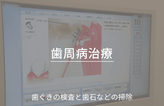 歯周病治療